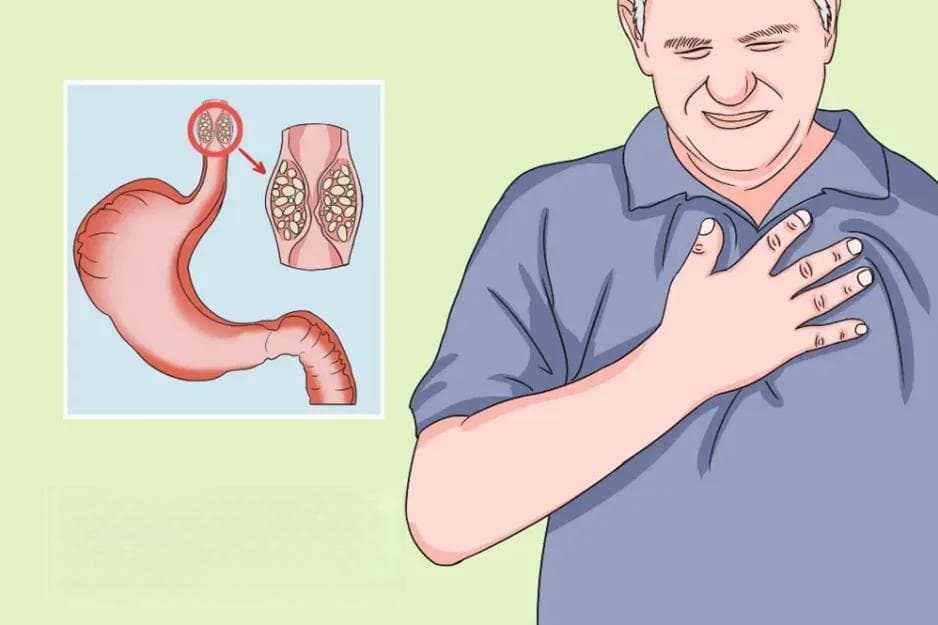 食管癌术后是否容易复发？如何预防？