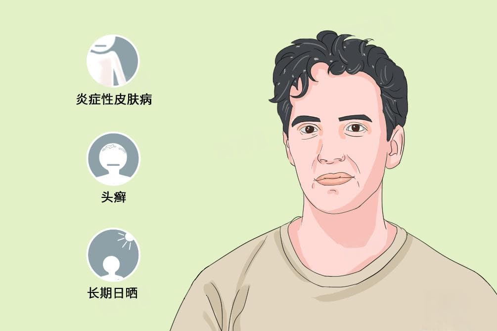头皮屑多如何去除？这些小妙招帮你轻松应对