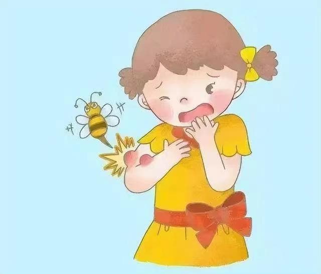 蜂蛰伤预防与应急处理