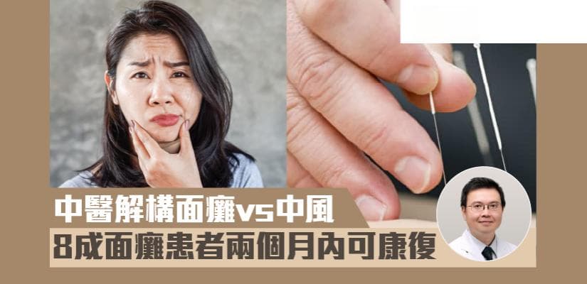 中醫解構面癱vs中風 8成面癱患者兩個月內可康復