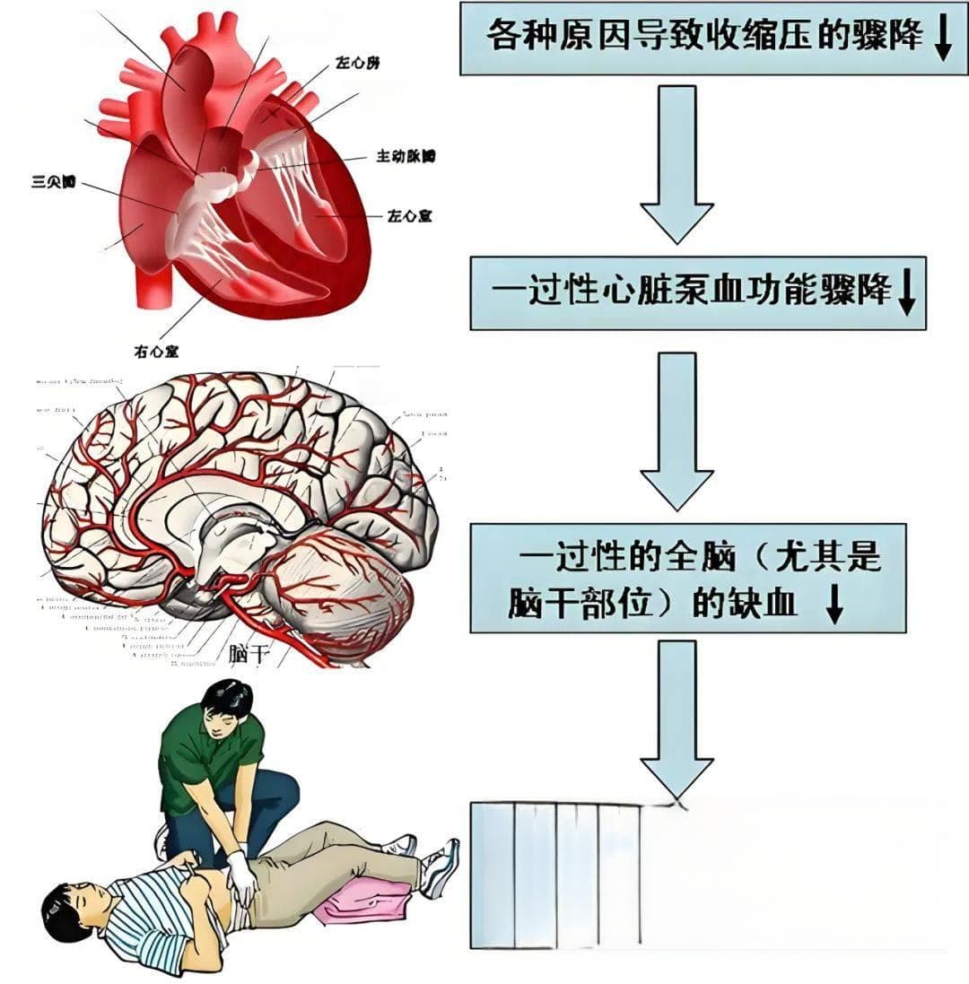 晕厥：大脑的“暂停键”，该如何应对？