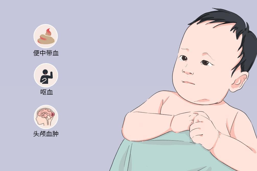 新生儿出血症