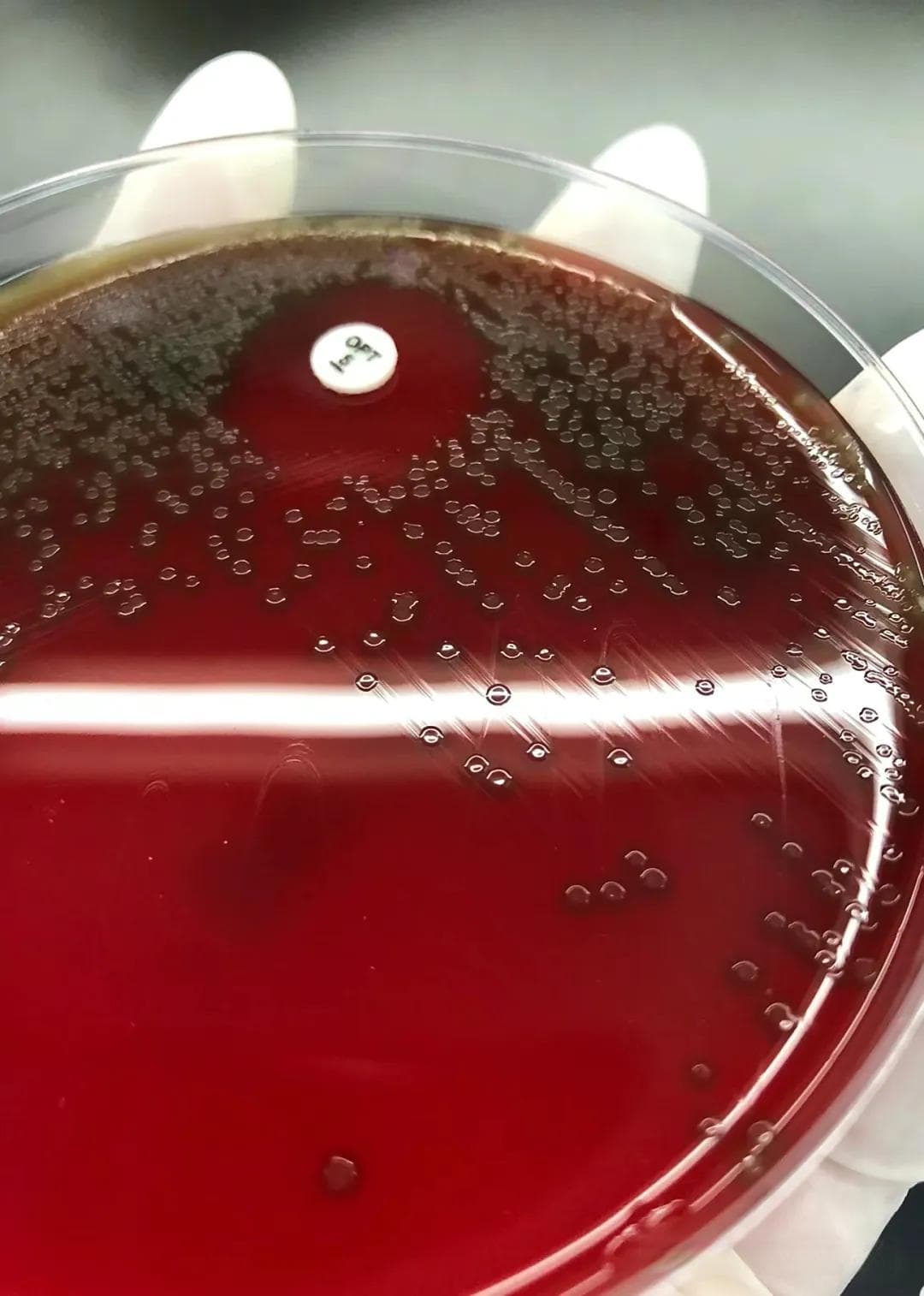 肺炎链球菌：一种重要的呼吸道病原菌