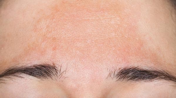 大腿出现红色斑点怎么办？多种原因及应对方法详解