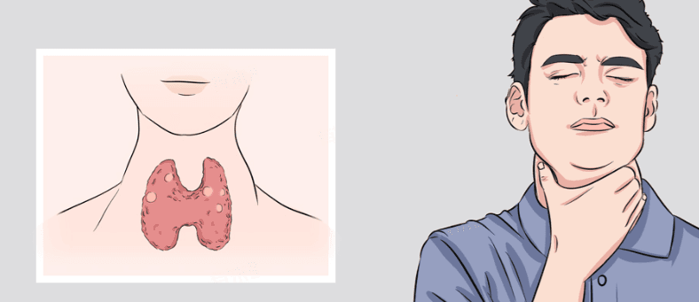 甲状腺结节是什么病，引起的原因是什么