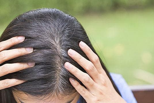 用脑过度会生白头发？6个原因让你了解白发生成机制