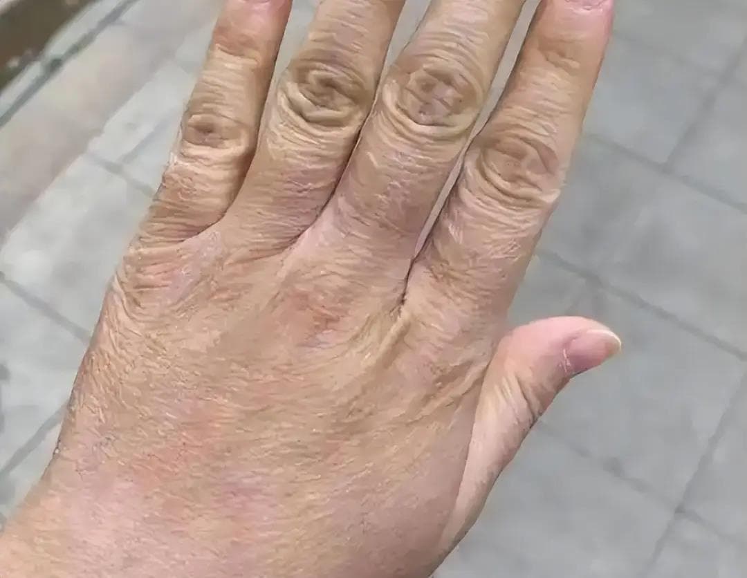 人老后皮肤总瘙痒？三种润肤方式用对，皮肤润泽不痒