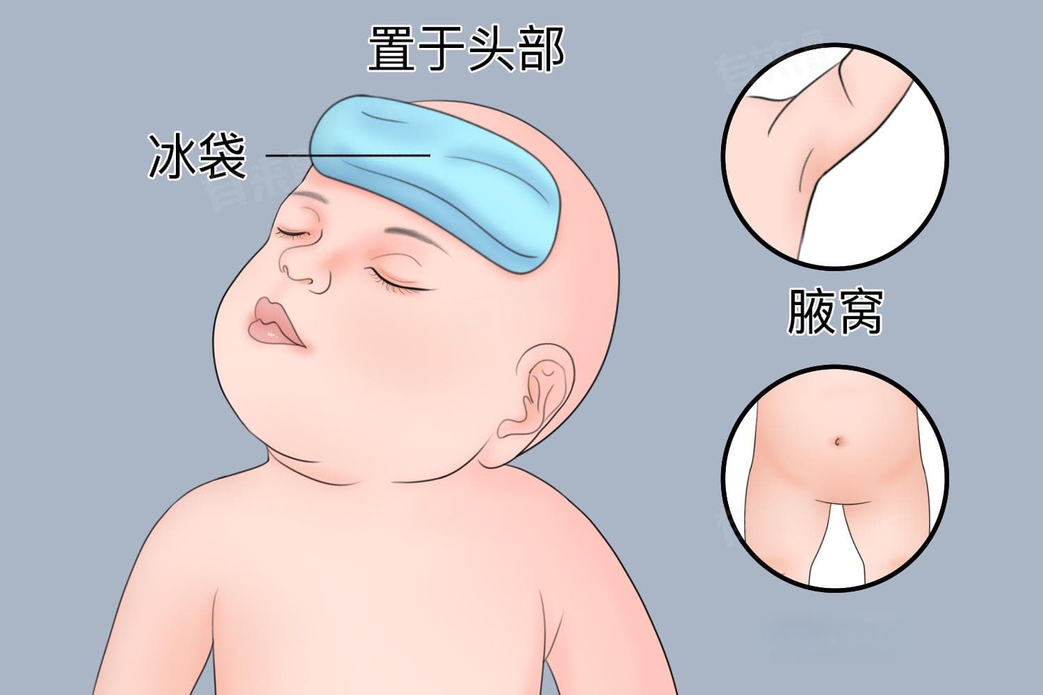 婴幼儿发烧38度怎么办？专业处理指南