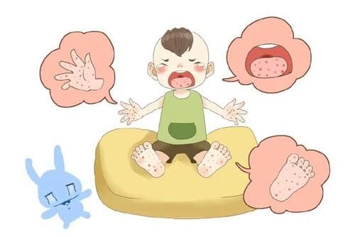 手脚上这些皮疹是手足口病？妇儿医院感染科专家：身上出现这些症状，要高度警惕