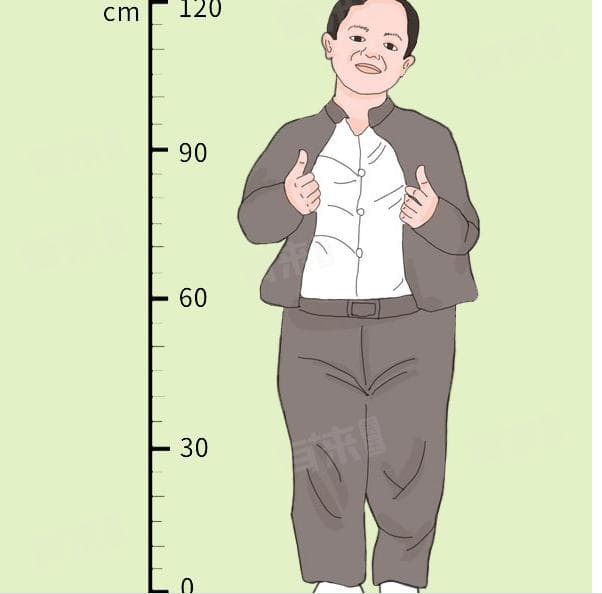 侏儒症身高一般多少