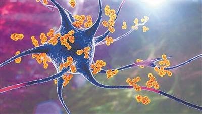 《自然》：CAR-T等技术让自身免疫性疾病治愈曙光初现