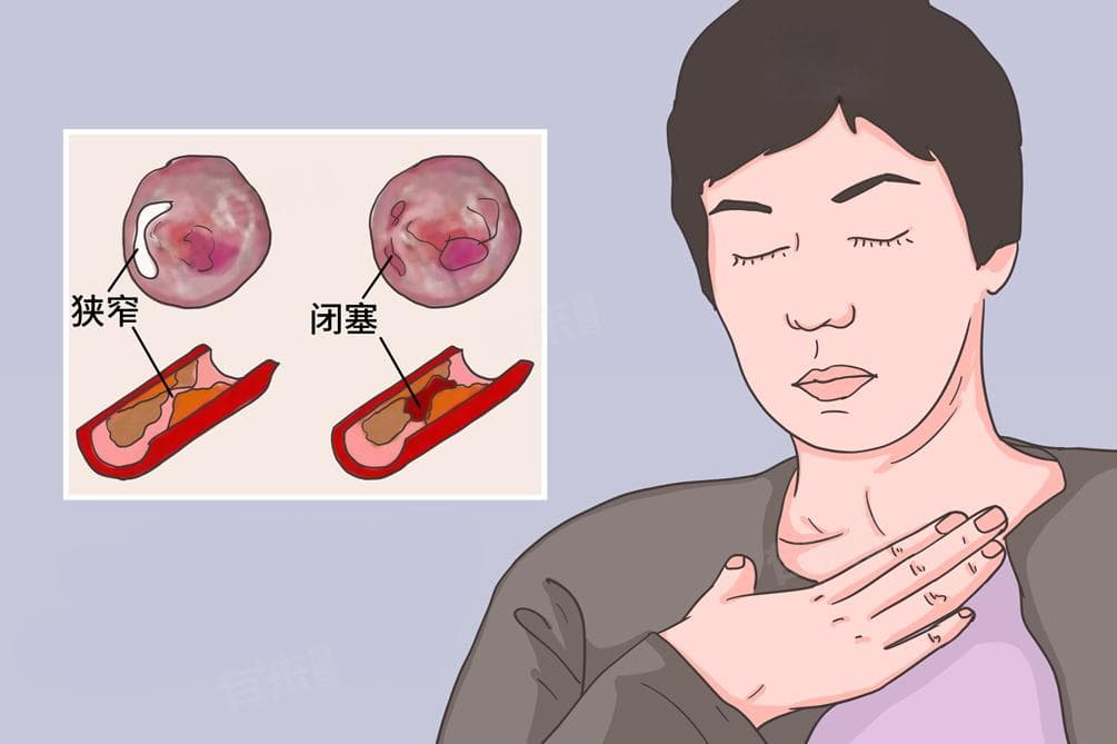 心脏缺血如何调养