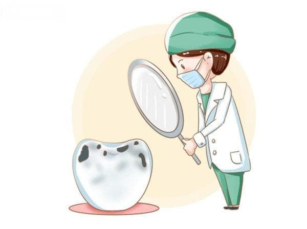 去补牙要注意什么套路和问题?掌握这几点补牙避坑指南不出错