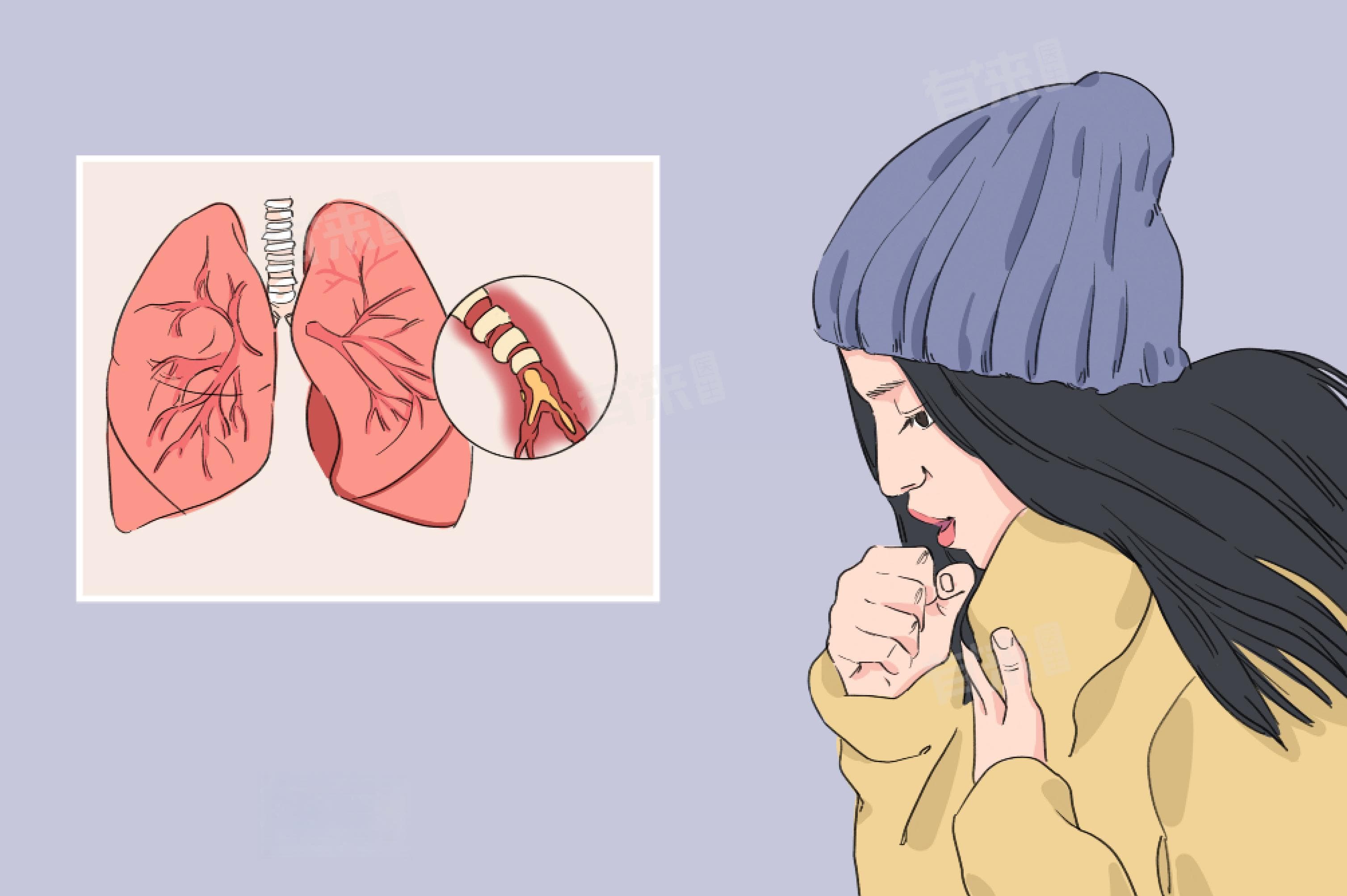 一直咳嗽怎么办？原因分析与处理方法全解析