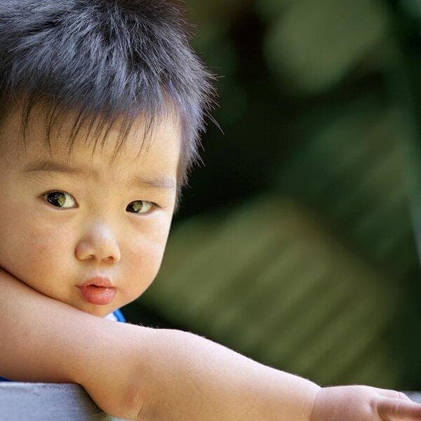 小孩脸不对称看什么科