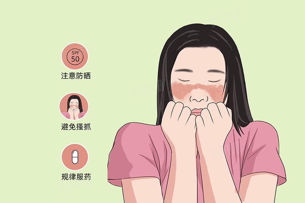 红斑狼疮的早期症状是怎样