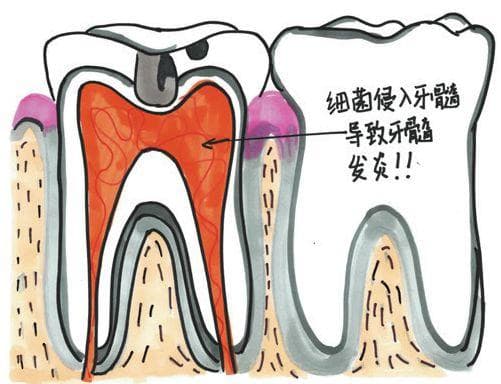 如何区分普通牙痛与心源性牙痛？