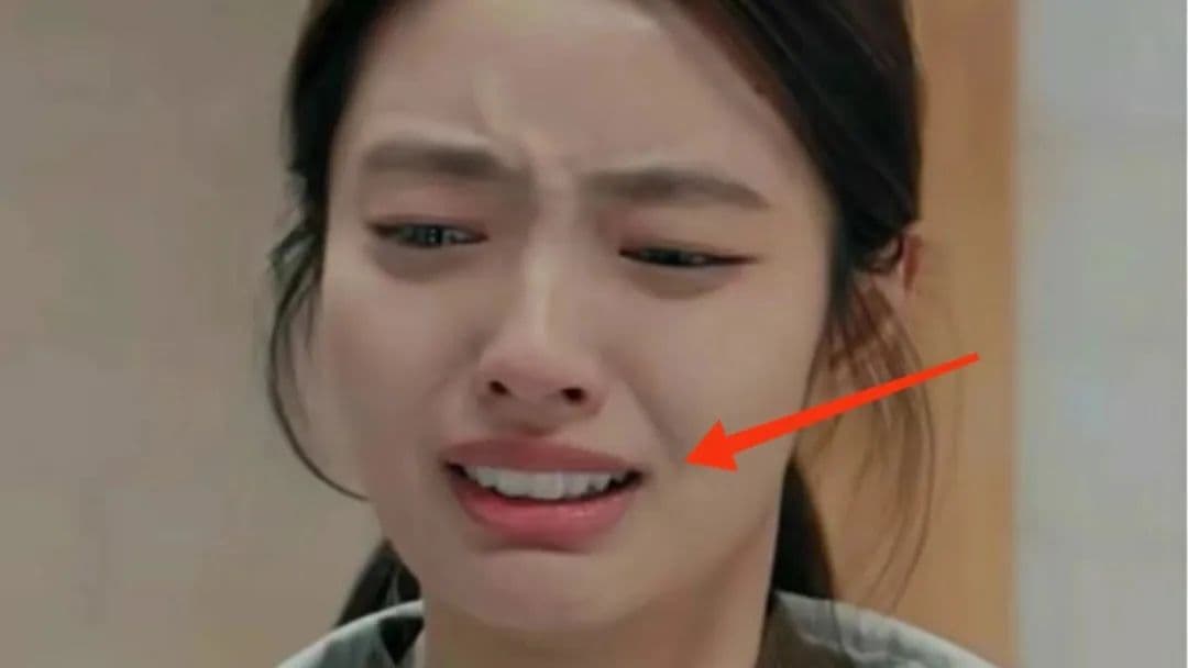 徐若晗不整兔牙，不可以吗？