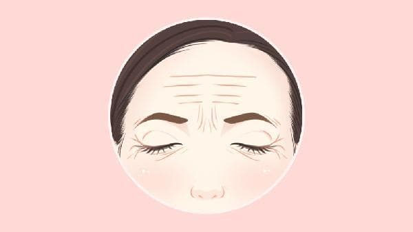 激光去除抬头纹的五大优势：安全、精准、恢复快