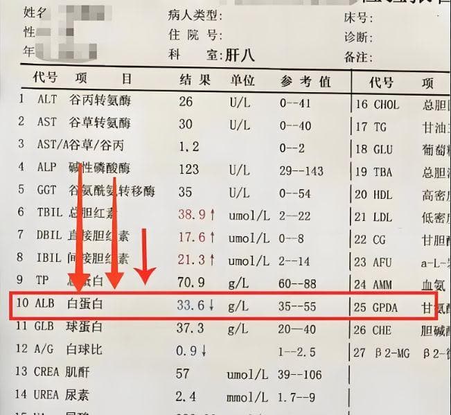重视起来！这几项指标评估肝硬化治疗效果！