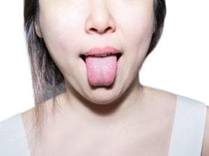 喉咙有异物感舌头发麻什么原因呢怎么治疗