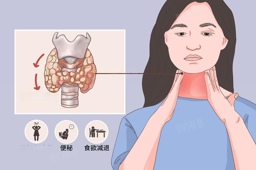 甲减看哪项指标