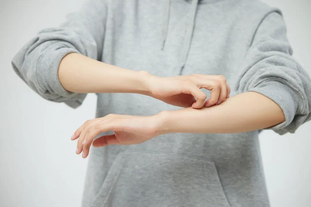 越痒越挠，越挠越痒……如何远离这种恼人的皮肤病