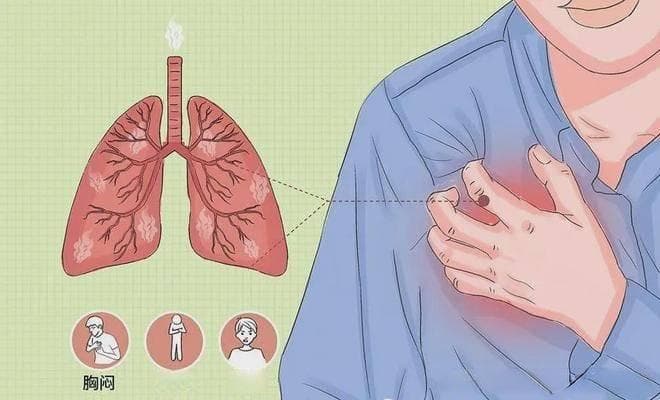 胸腔积液抽好还是不抽好：一个需深入探究的问题
