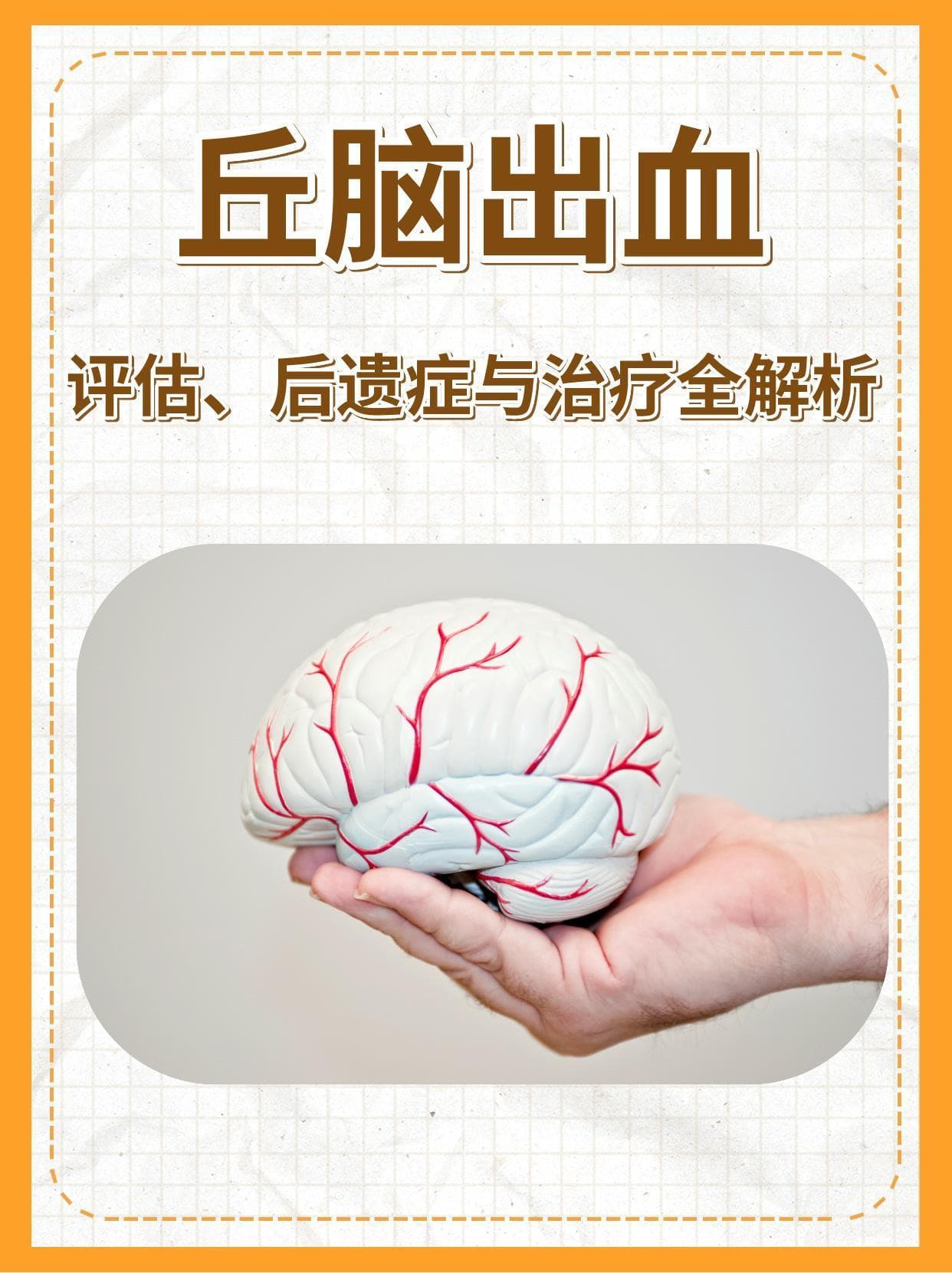 丘脑出血：评估、后遗症与治疗全解析