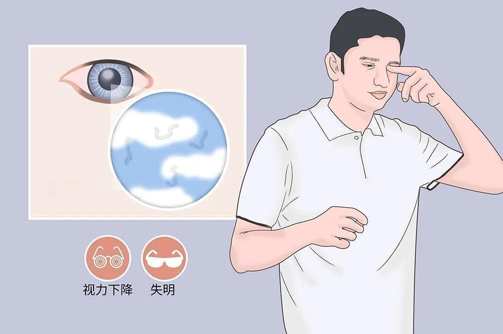 飞蚊症中医辨证治疗