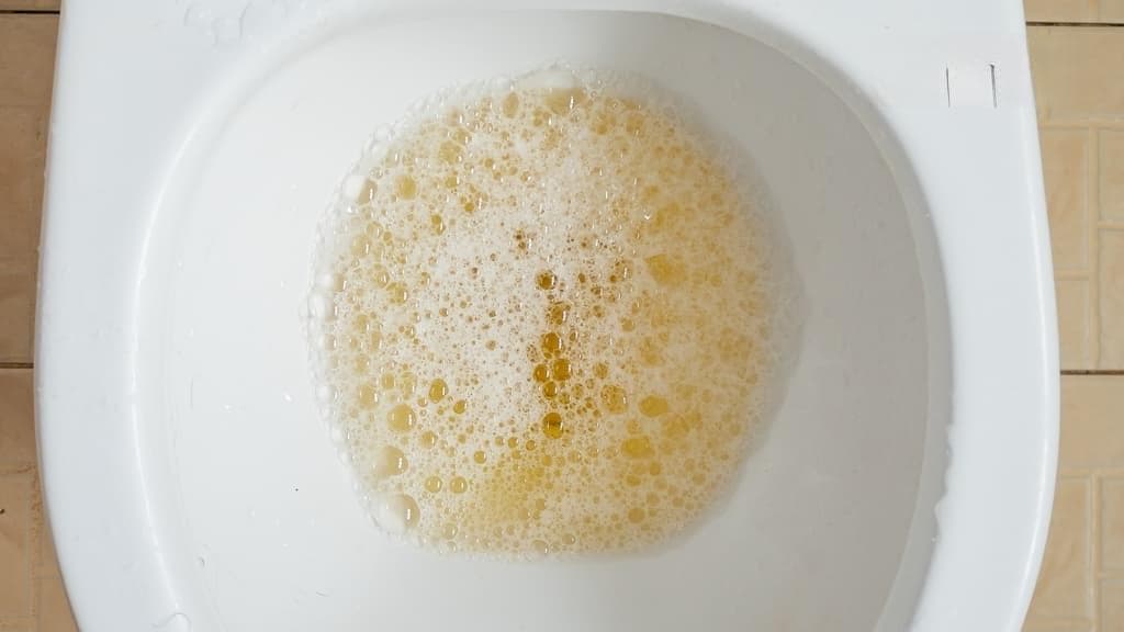 泡泡尿是肾病？专家解析蛋白尿成因与预防方法
