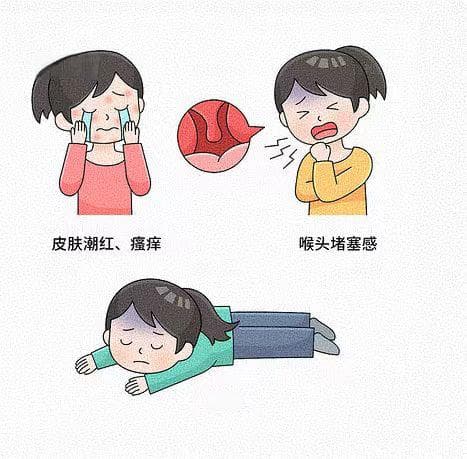 CT增强扫描时碘造影剂过敏怎么办？这份医学科普请收好