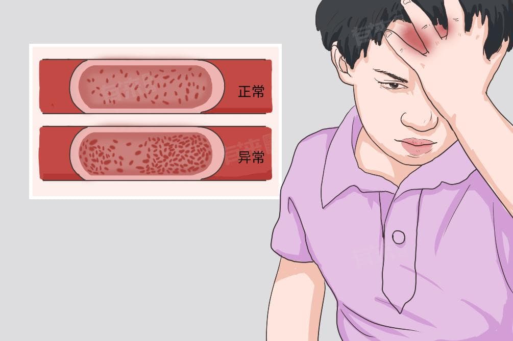 红细胞计数高说明什么问题