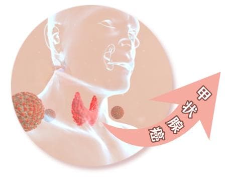 身体出现这6种变化，或是癌信号！年轻人和女性尤其注意！