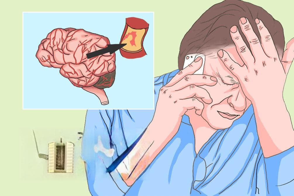 脑血栓形成的救护原则