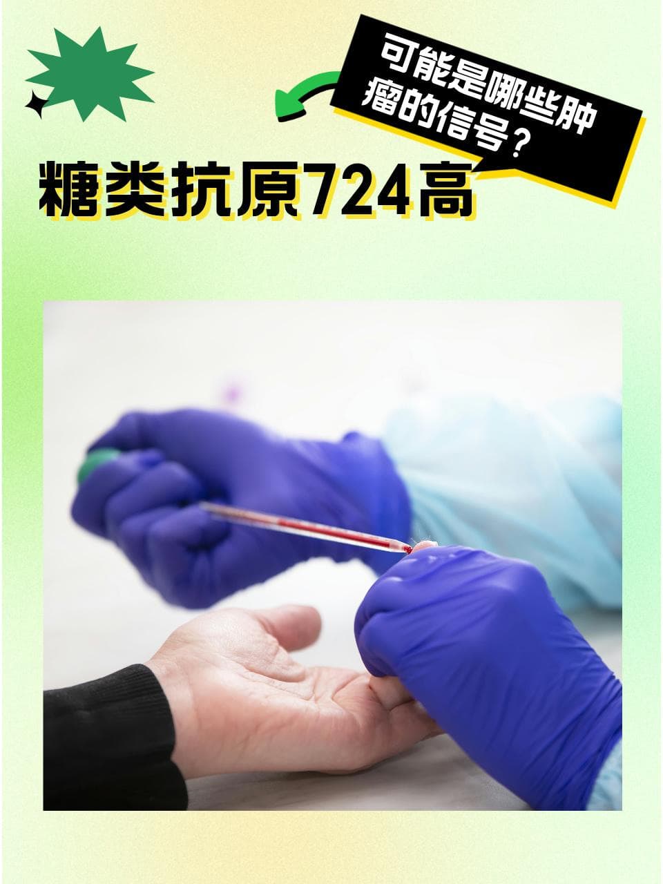 糖类抗原724高，可能是哪些肿瘤的信号？