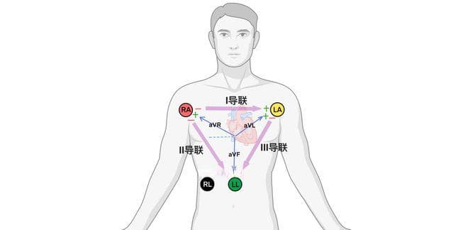 心电图导联相关知识，看这一篇就够啦！