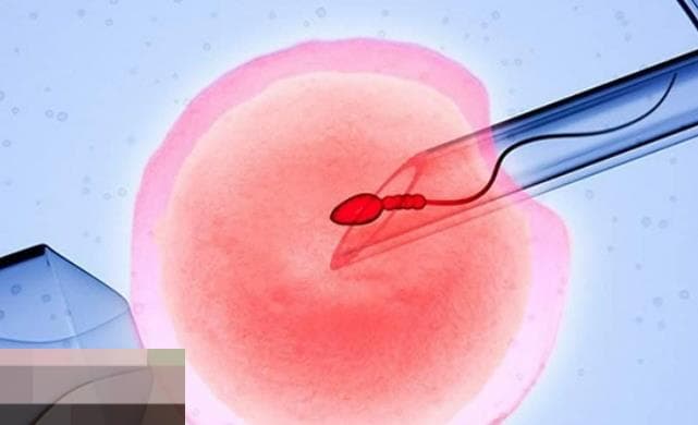 一文解析第三代试管婴儿基因筛查技术在高龄备孕中的应用