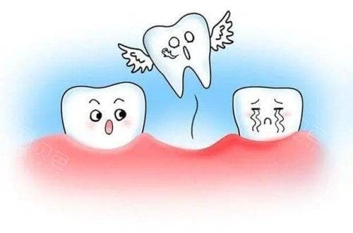 揭秘牙齿寿命：理论上可伴随一生，这些因素影响牙齿健康
