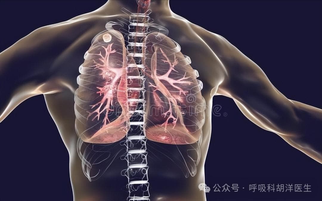 肺部结节发生哪些改变恶性可能性增大，普通人也能掌握