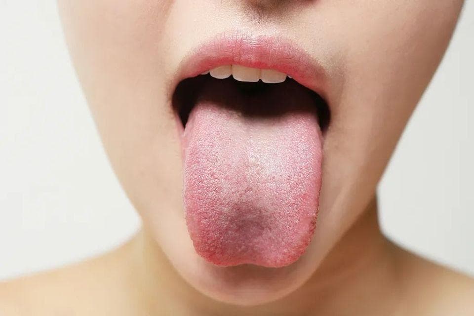 身体好不好，看舌苔就知道出现这3种颜色要注意