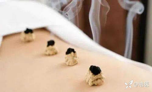 盲目艾灸不可取！艾灸的禁忌与注意事项