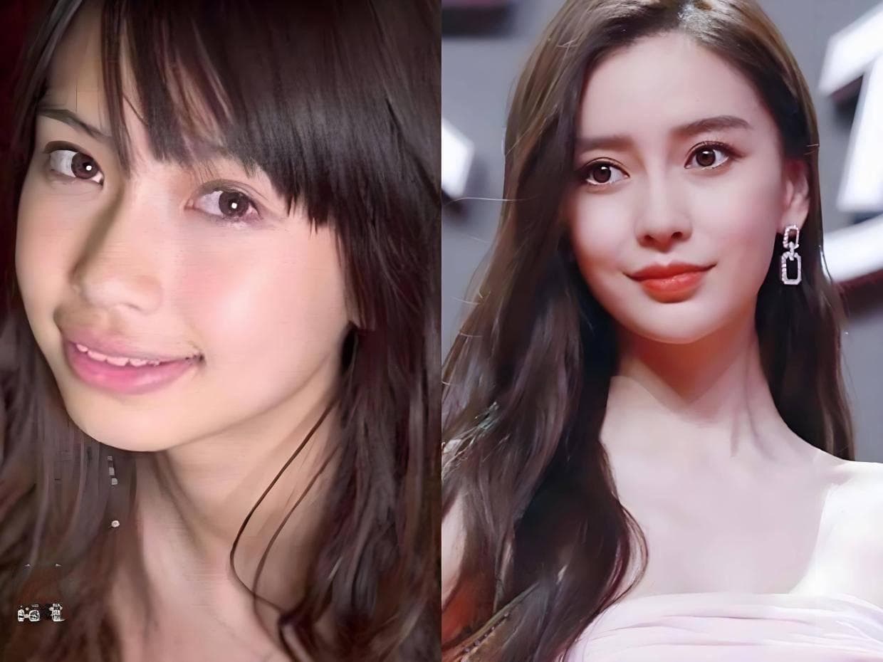 为什么牙齿矫正会让人变得美丽自信？