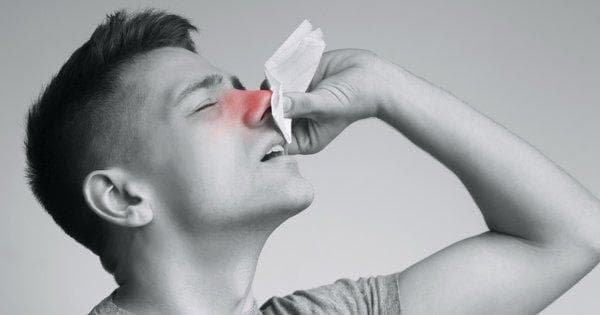 鼻出血常见的病因病机有哪些