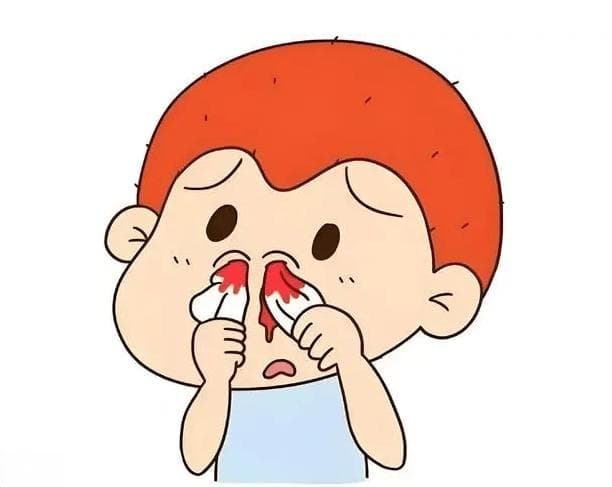 止住鼻血：流鼻血的紧急处理与预防措施