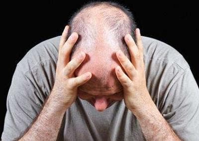 斑秃会复发吗？如何防止复发？