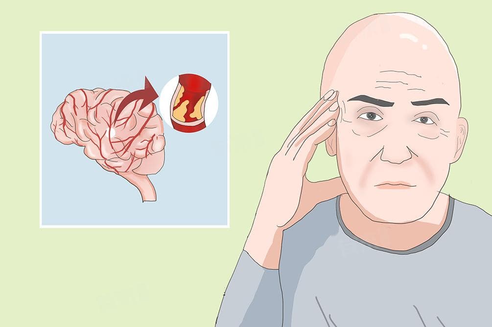 看脑血管挂什么科