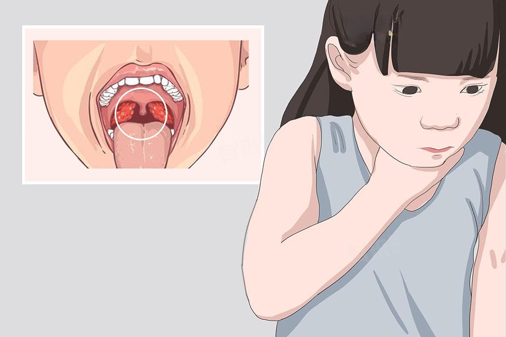 小孩嗓子沙哑怎样快速恢复