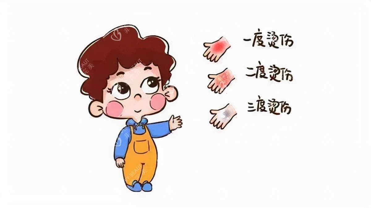 被烫伤了如何判断烧伤严峻程度？四种烧烫伤对比图教你快速判断等级，附更优处理办法