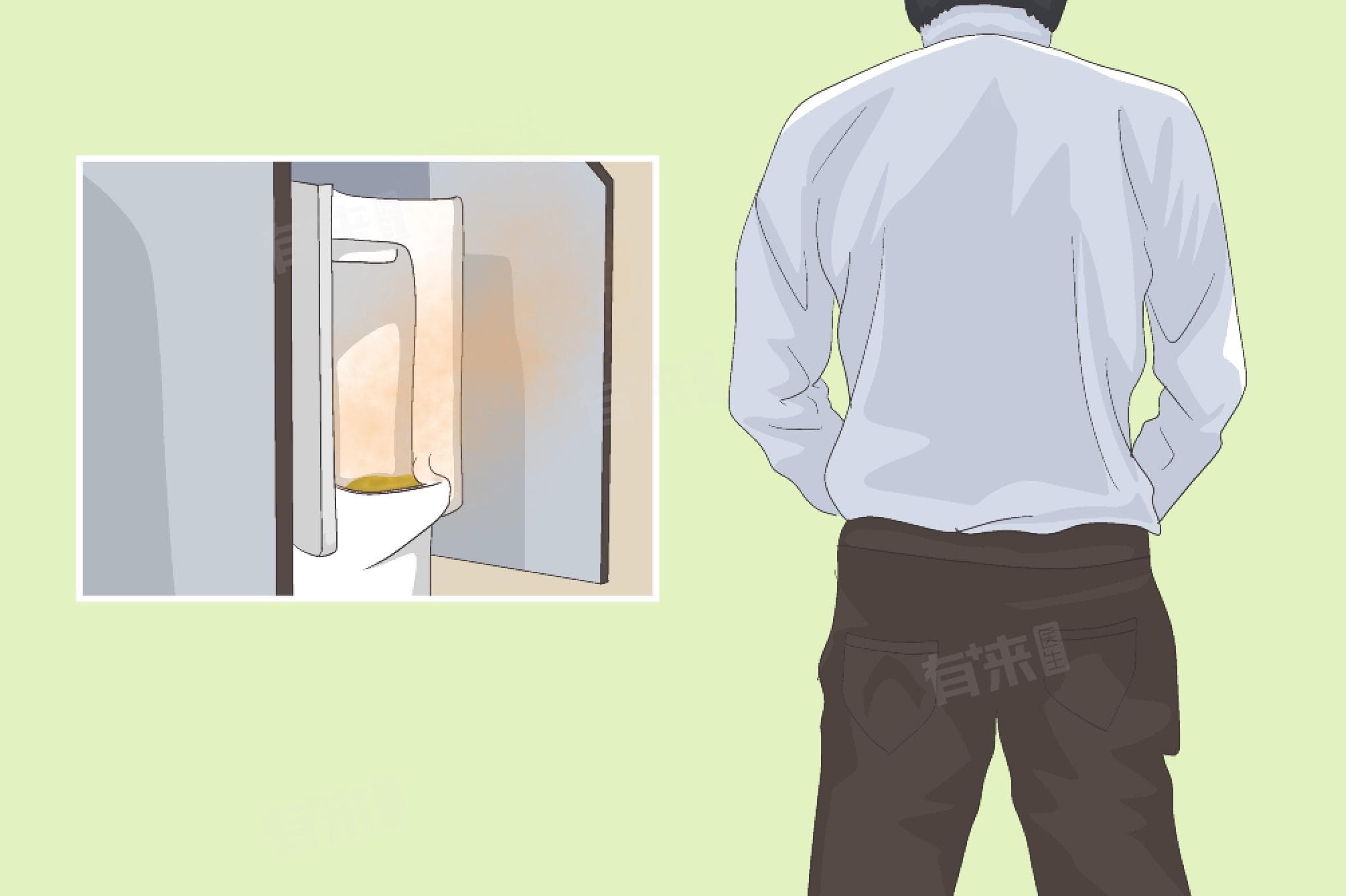 尿臭味重是什么原因